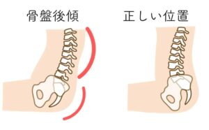 上の図のように骨盤を立てた状態というのが純粋な股関節の動きです。
この骨盤を立たせた状態のほうが股関節にうまく効かせた効果的なストレッチができます。