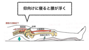 
仰向けで寝る場合に最も大切なことは「膝を曲げて寝ること」です。
上の図のように足を伸ばして寝てしまうと腰が床から浮いた状態になります。
この状態は腰の筋肉や太ももの筋肉が引っ張られる力が働いてしまい過剰に坐骨神経にストレスが加わります。
私にも経験がありますが、腰痛やぎっくり腰の時こそ足を伸ばして寝ることの方がとても辛かったです。