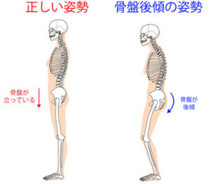 股関節が硬い状態を柔らかくするためにはまず初めに骨盤を立てるストレッチから始めます。
骨盤が倒れた状態、骨盤が後ろに傾いた状態では股関節のストレッチをしても効果が発揮できません。
無理にストレッチをしたら股関節を痛めてしまう恐れがあります。

よくある股関節のストレッチで床に座った状態で足裏を合わせて股関節を開くストレッチがあります。
股関節が硬い方は両膝が外に倒れなかったり、左右どちらかがだけが横に倒れない状態の場合があります。
その原因にはストレッチ中の姿勢で骨盤が後傾している可能性があります。