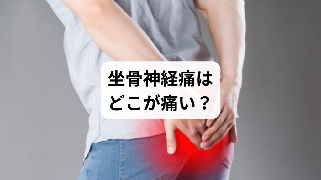【坐骨神経痛はどこが痛い？】症状の特徴と鍼灸・整体による根本改善法