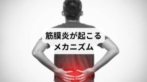 筋膜炎は、筋肉を覆う膜である「筋膜」が炎症を起こすことで発症します。筋膜は筋肉同士の滑らかな動きを助ける役割を持ちますが、過度な負荷や長時間の同じ姿勢、血流不足などによって硬直し、炎症が生じます。特にスポーツ選手やデスクワーカーに多く見られ、肩・腰・足裏などに痛みが集中するのが特徴です。「筋膜炎の原因」を理解することが、早期の「筋膜炎の改善」につながります。
