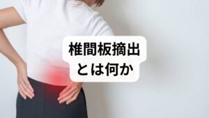 椎間板摘出（discectomy）は、飛び出した椎間板（髄核）が神経を圧迫することで生じる坐骨神経痛や下肢のしびれを軽減するために、突出物を除去する手術です。一般に保存療法（薬物療法・理学療法・注射療法）で6〜12週間改善しない場合や、進行性の筋力低下・排尿障害など神経学的悪化がある場合に手術が検討されます。術前の画像所見と臨床症状の一致が重要です。
